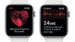 iOS 14.2/watchOS 7.1 正式版即将发布，苹果 Apple Watch ECG 功能将登陆韩国