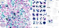 聚焦病理 AI：英特尔与江丰生物生态协同共闯智慧医疗蓝海