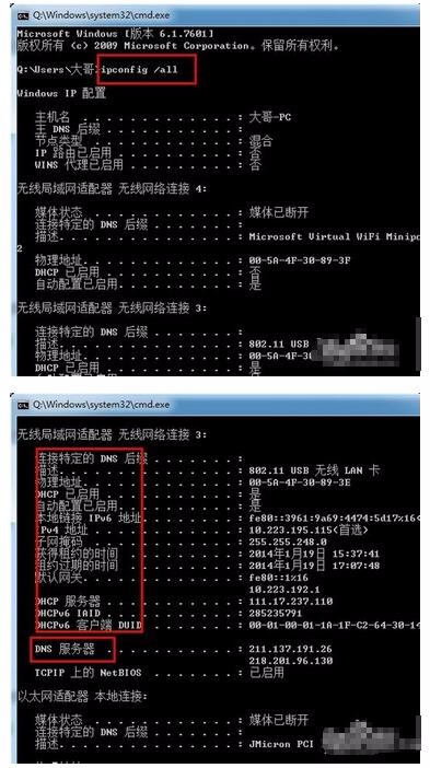 win10电脑网络诊断提示该设备或资源(DNS服务器)没检测到响应