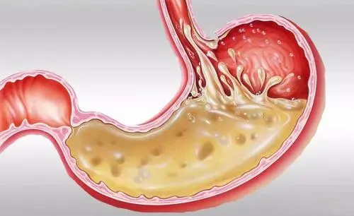 胃酸腐蚀能力强大，正常状态下，它为什么不会消化掉人的胃