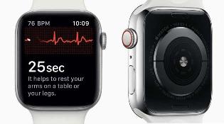 22 岁国外小哥通过 Apple Watch 发现心脏问题